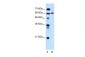 KIAA1754L antibody - C-terminal region